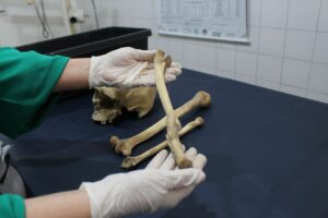 Imagem da notícia - Peritos do Amazonas usam antropologia forense para identificar ossadas humanas